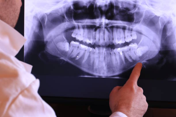Best Emergency Root Canal Treatment in Pearl River, MS