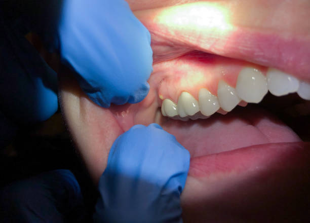 Best Walk-In Emergency Dentist in Pearl River, MS
