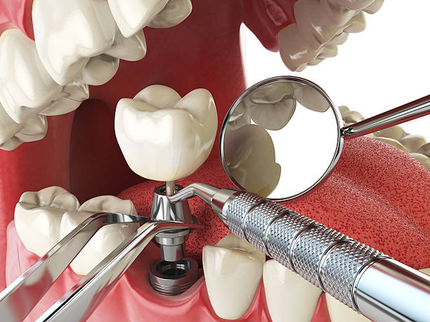 Best Emergency Dental Surgery in Pearl River, MS