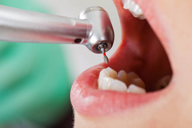 Best Emergency Dental Surgery in Pearl River, MS